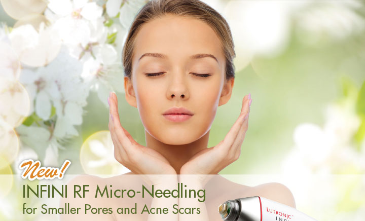 NEW! INFINI RF Micro-Needling for Smaller Pores and Acne Scars